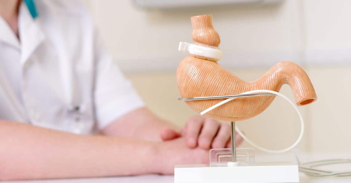 Lap Band Surgery Cost Without Insurance