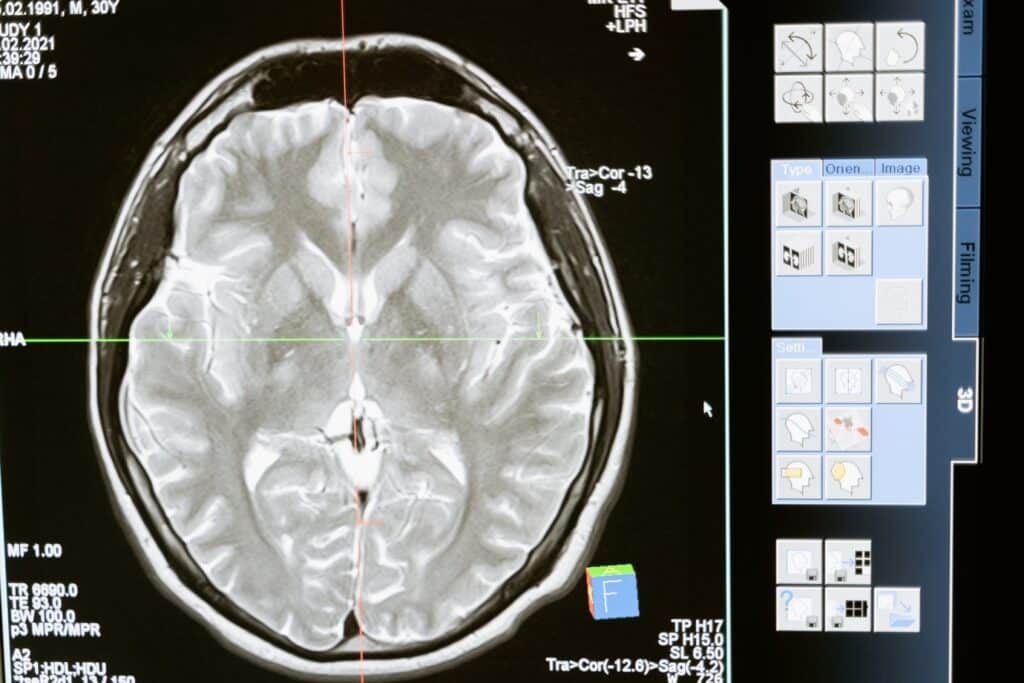 How to Become a Neurosurgeon