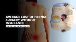 Average Cost of Hernia Surgery Without Insurance