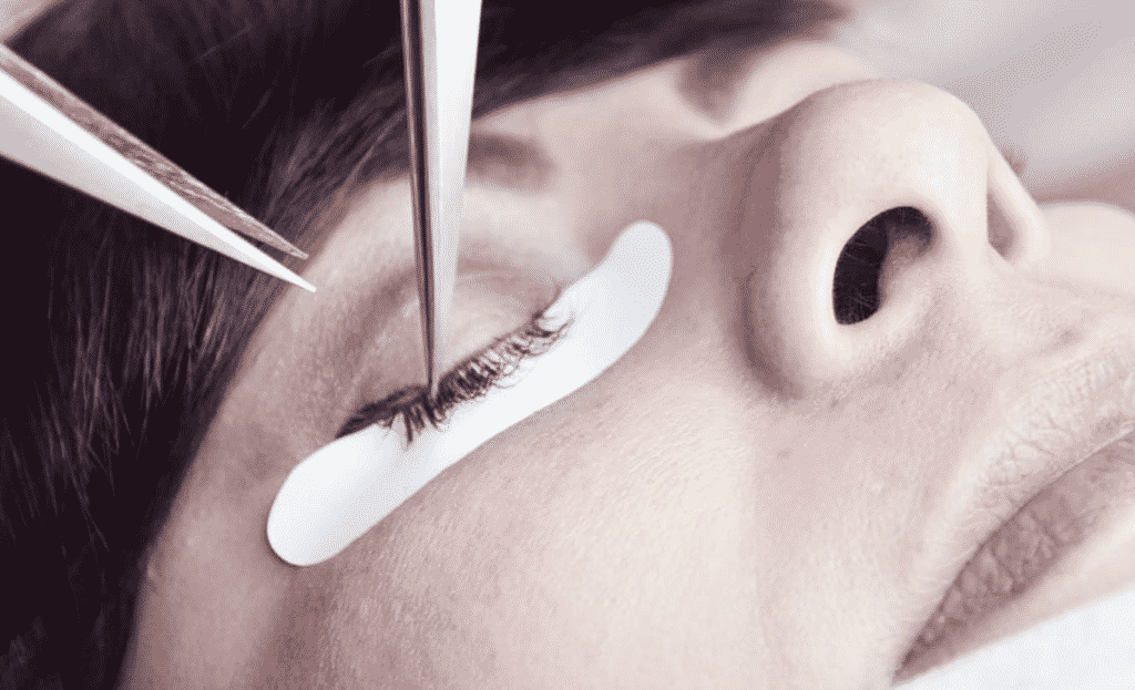 What is Microdermabrasion Treatment