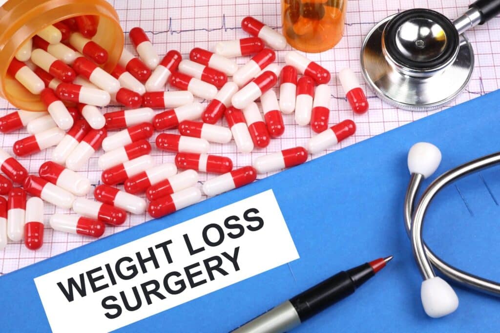 What to Expect From a Weight Loss Surgery? Grants for Medical