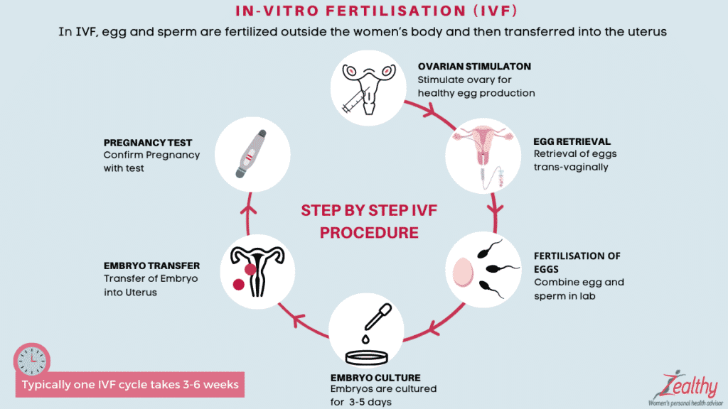 The Five Stages of IVF Grants for Medical