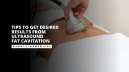 Ultrasound Fat Cavitation