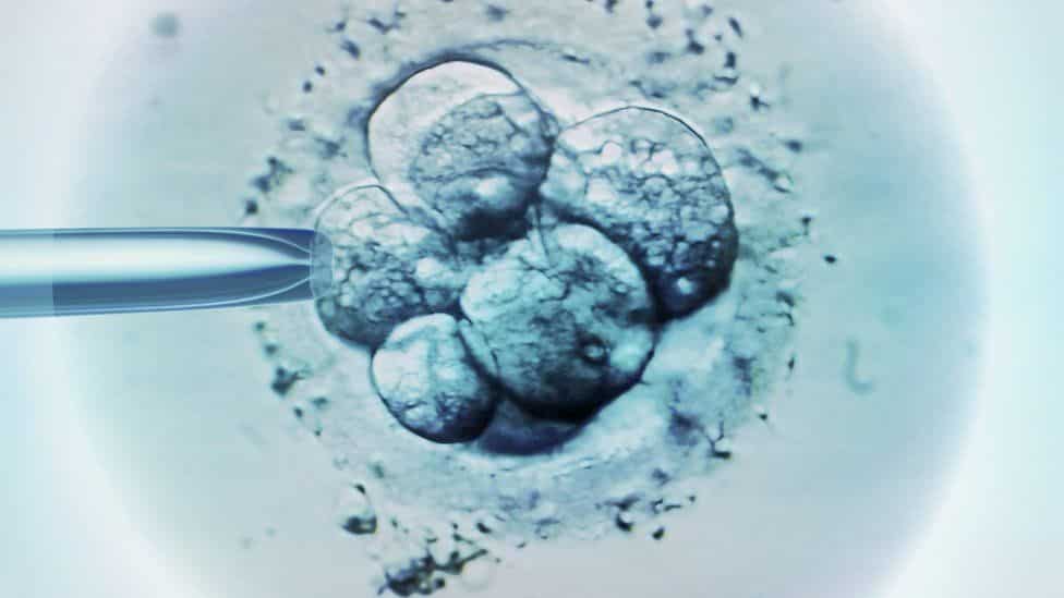 Full Cycles of IVF