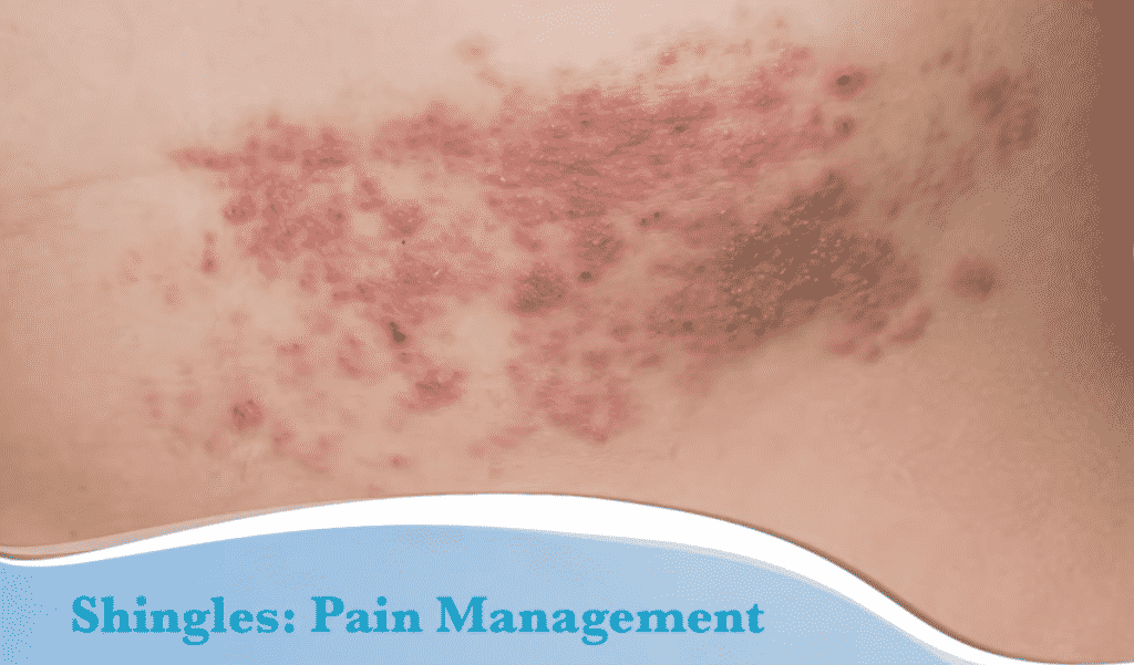 Does Medicare Cover Shingles Shots