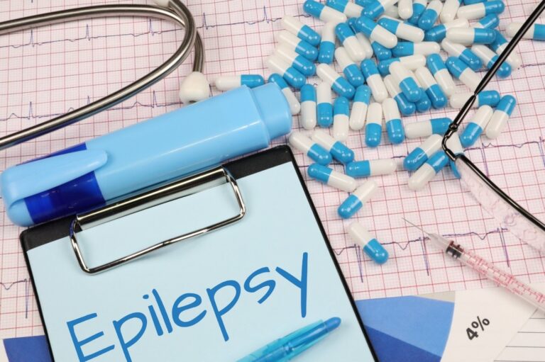 Epileptic Patients