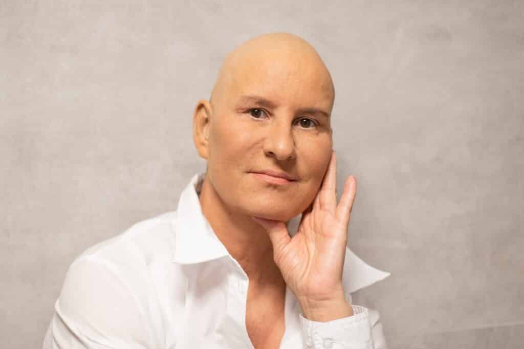 Chemotherapy Patient Education