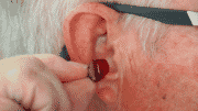 Does Medicaid Cover Hearing Aids