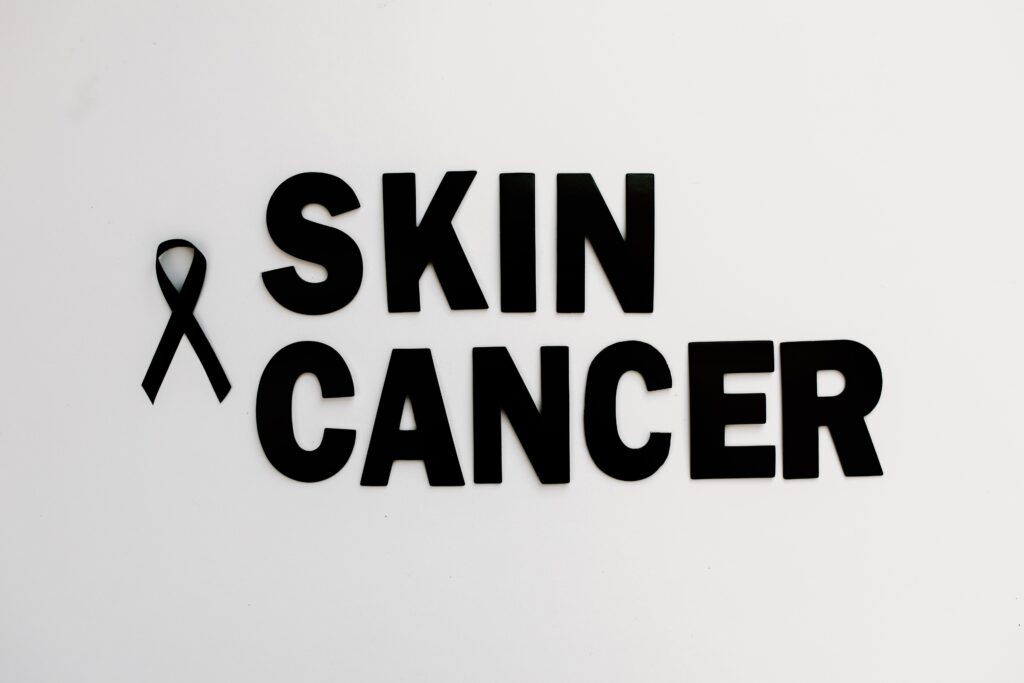 Skin Cancer Grants - Check Here