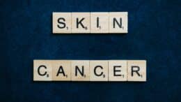 Skin Cancer Grants