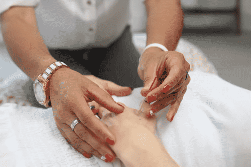 Does Medicare Cover Acupuncture