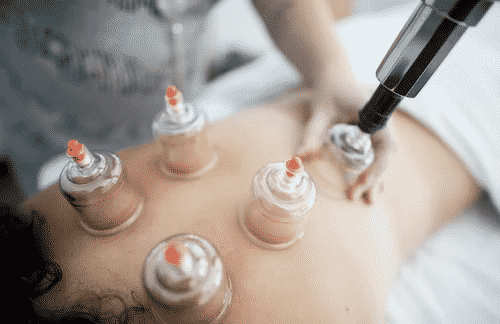 Does Medicare cover Acupuncture