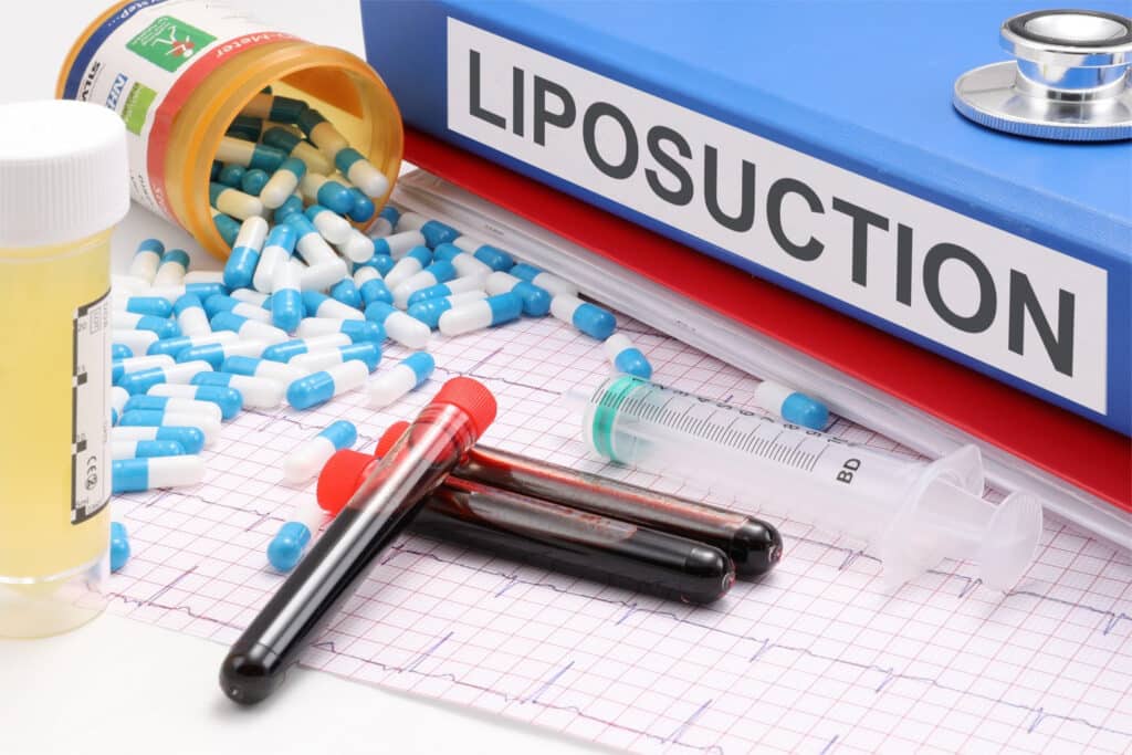 Does Medicare cover Liposuction