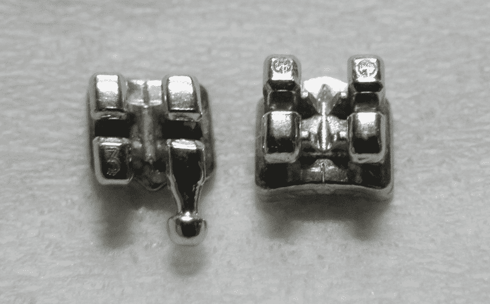 How Long Do Braces Last? Grants for Medical