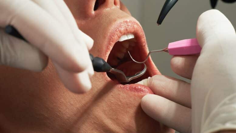 Dental Implant Grants in Minnesota