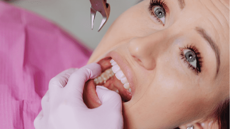 Does Medicare cover Braces