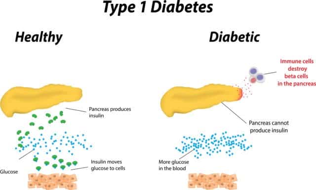 How To Educate Diabetic Patients