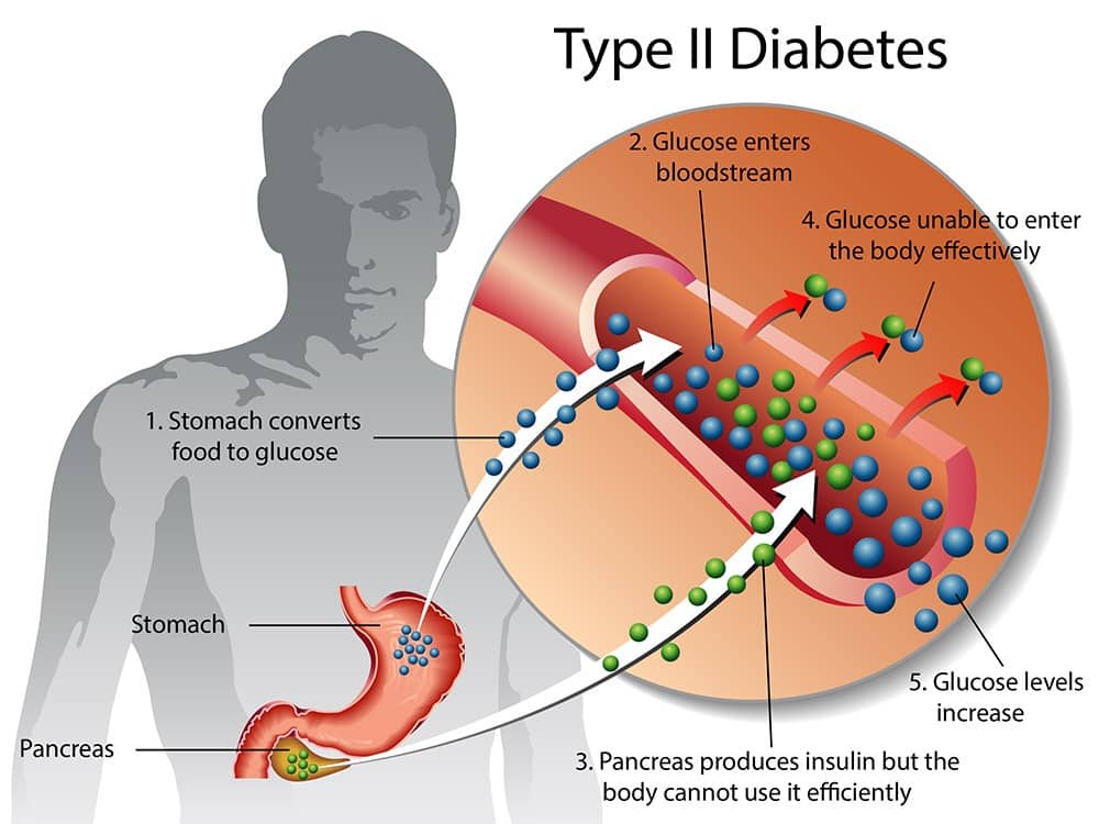 How To Educate Diabetic Patients