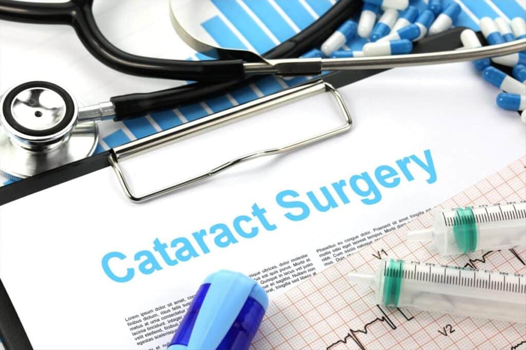 After Cataract Surgery Care - Overview