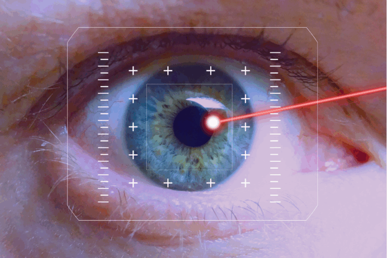Cataract Surgery Cost
