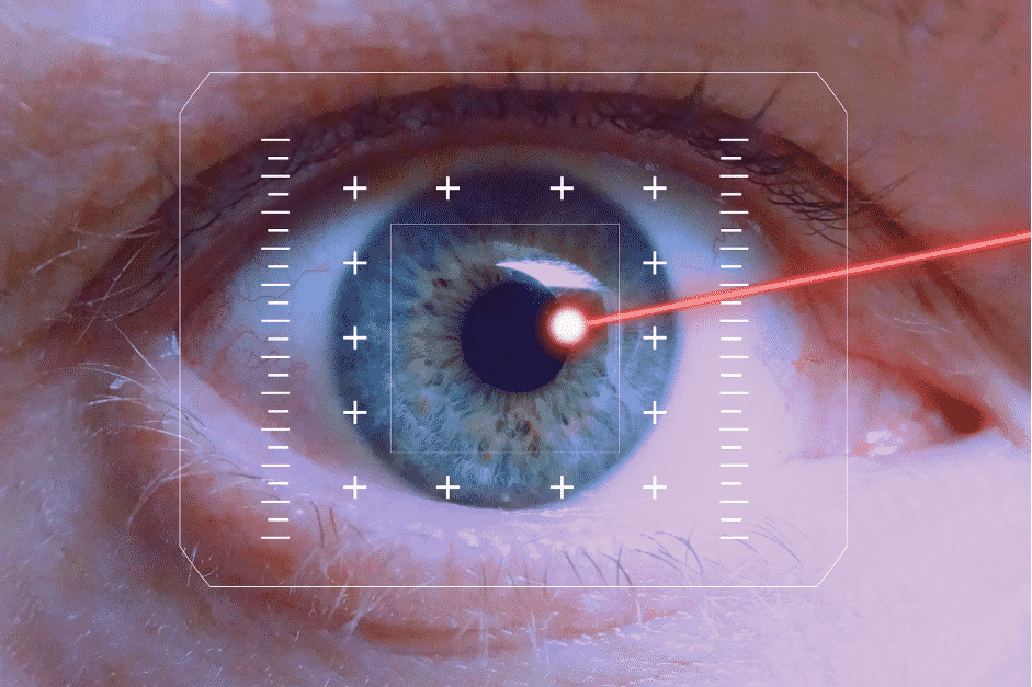 Cataract Surgery Cost