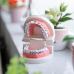 Dental Grants in Connecticut