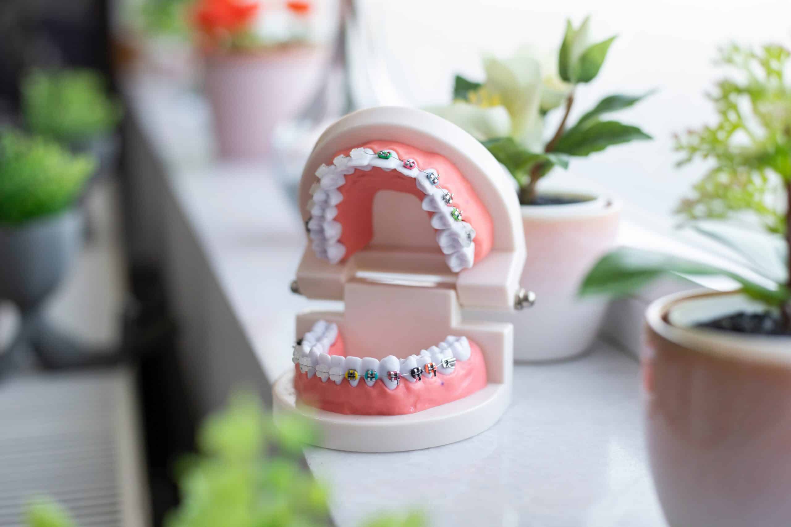 Dental Grants in Connecticut
