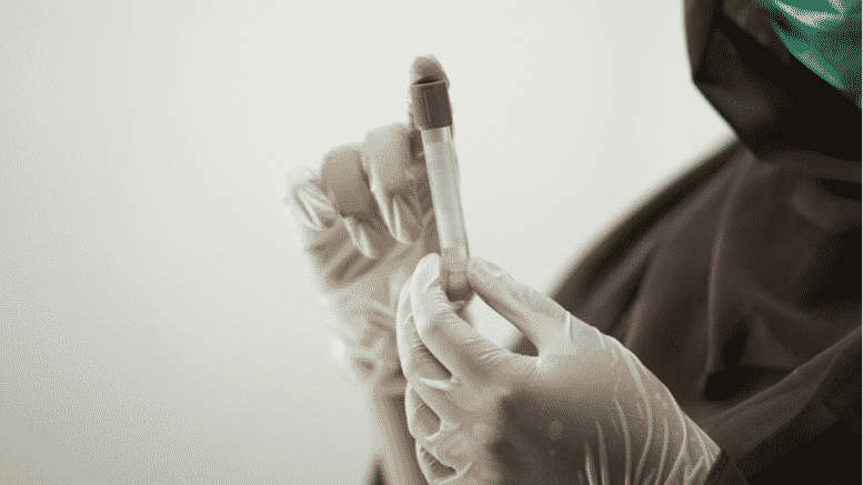 Gender Blood Test at Doctors office