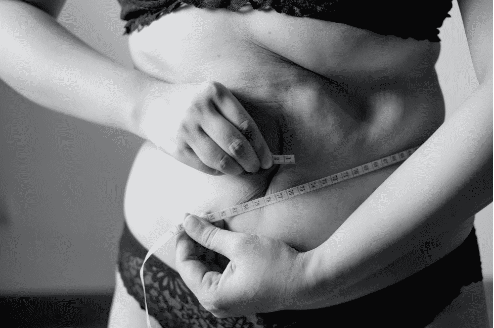 Mommy Makeover Cost in Chicago