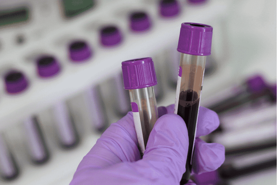 Gender Blood Test at Doctors office