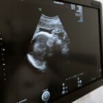 Sonography Programs in Louisiana