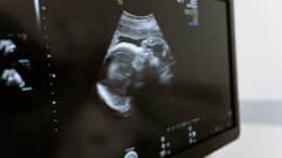 Sonography Programs in Louisiana