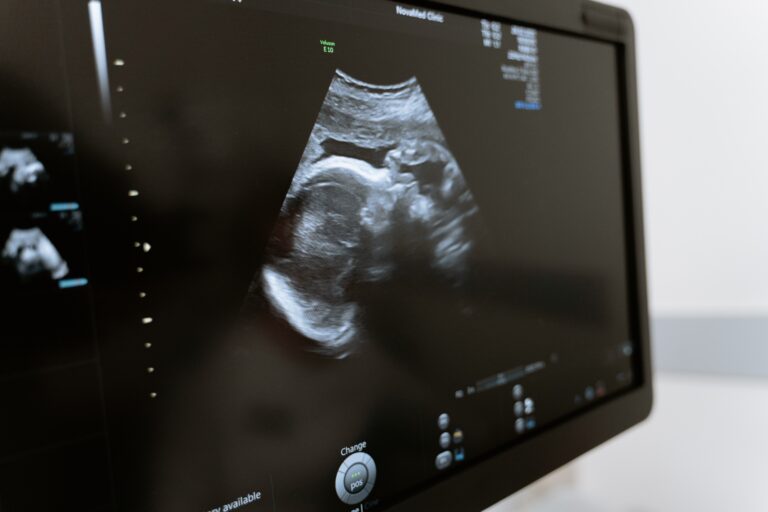 Sonography Programs in Louisiana