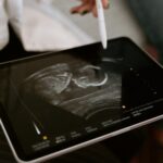 Sonography Programs in Ohio