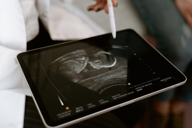 Sonography Programs in Ohio