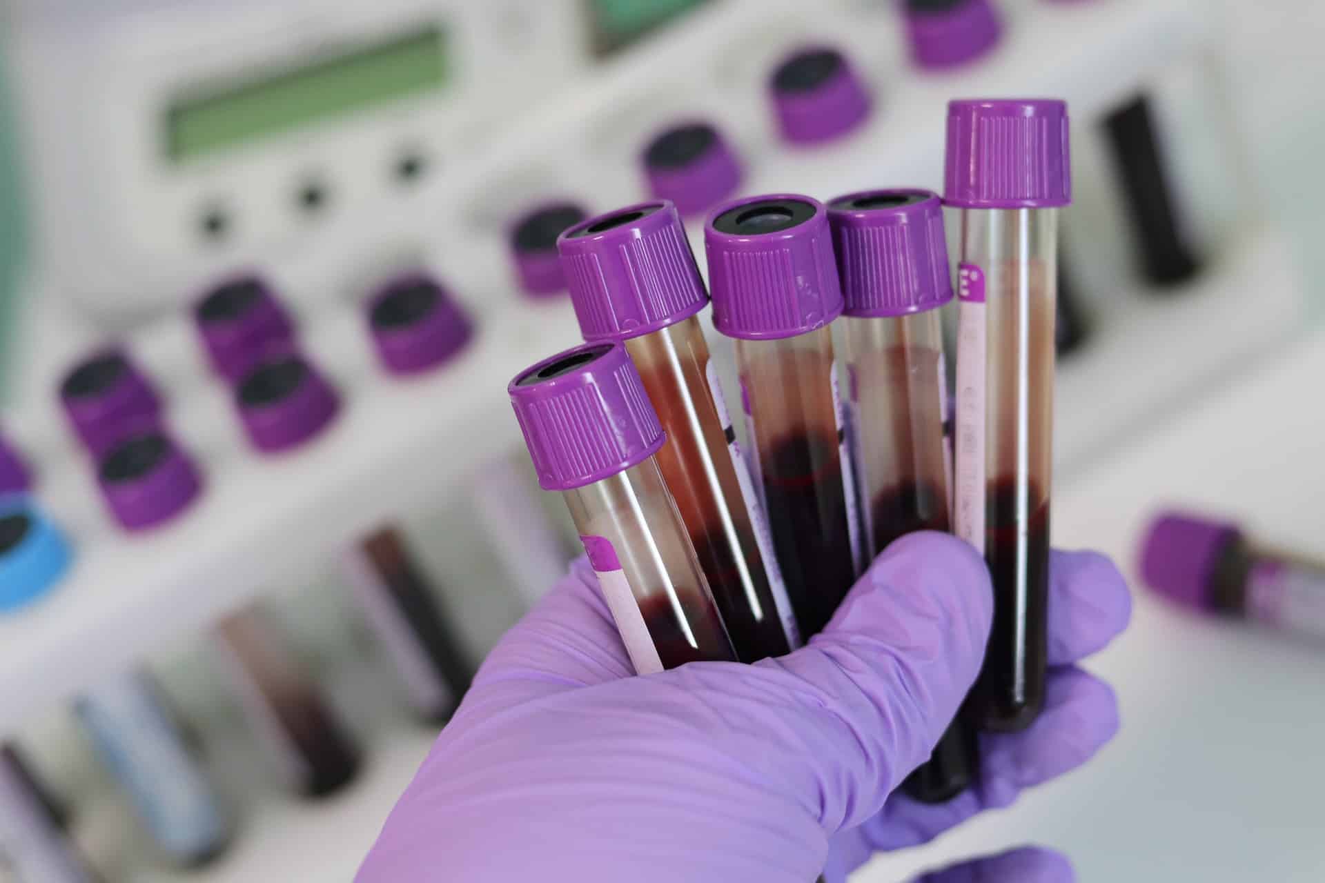 Creatinine Lab Values