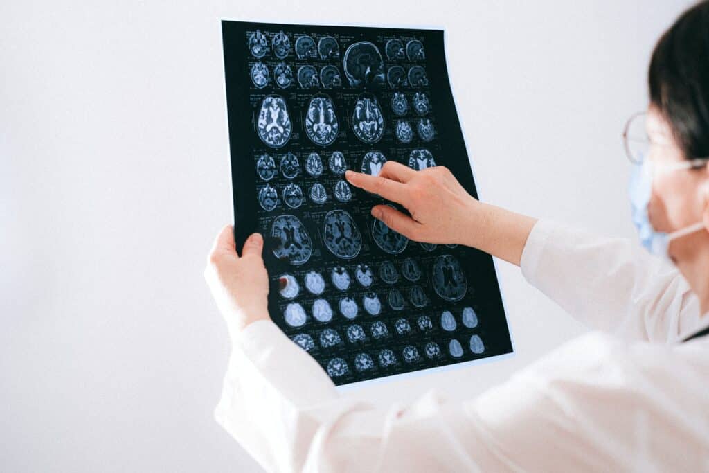 Neurology Grants