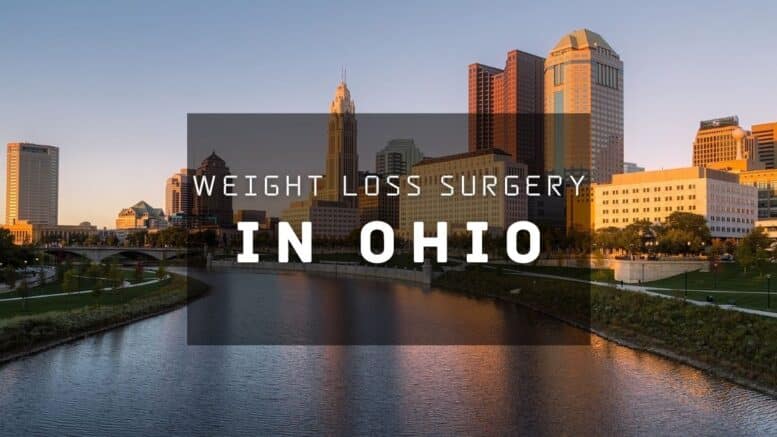 Weight Loss Surgery Ohio