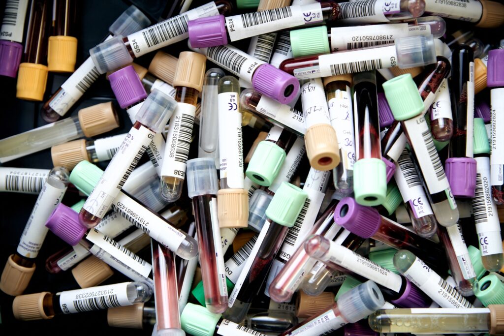 What is Creatinine Level in Blood Test
