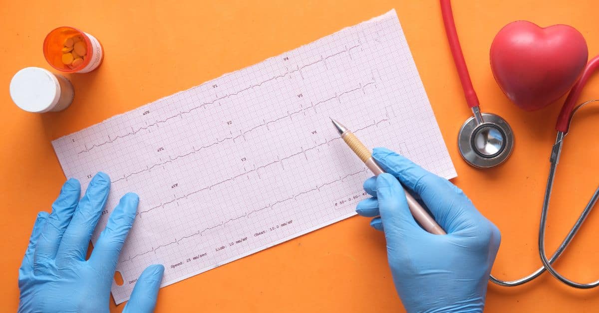 Electrocardiogram Patient Education