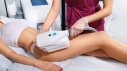 Is CoolSculpting Permanent