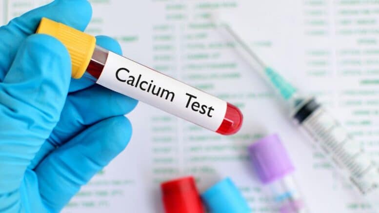 Calcium Lab Values | Understanding the Results