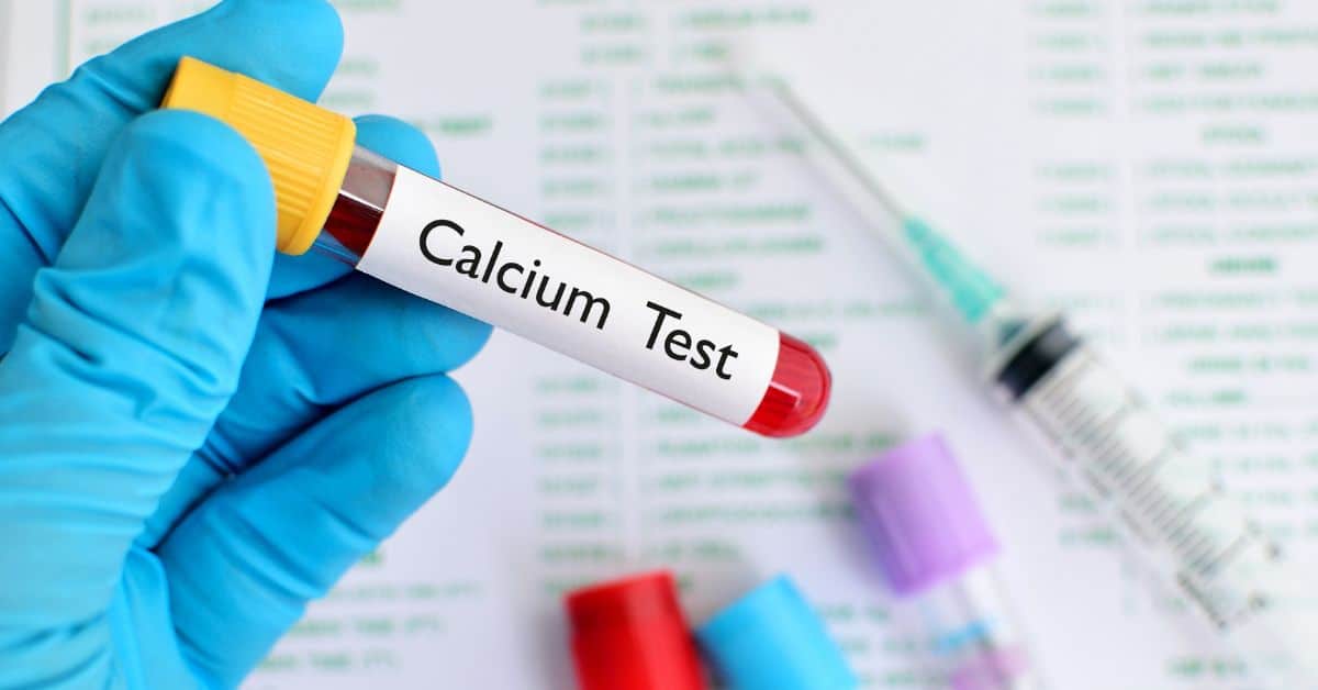 Calcium Lab Values