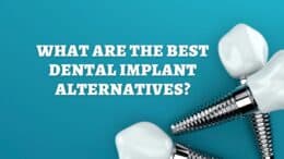 Dental Implant Alternatives