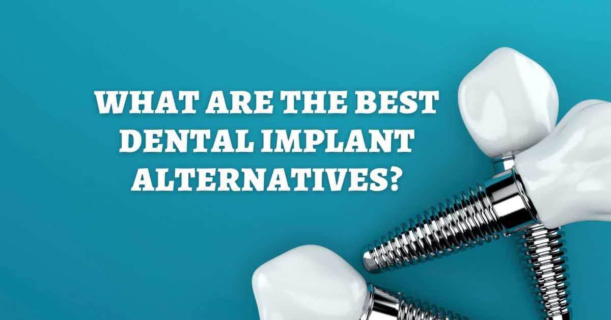 Dental Implant Alternatives