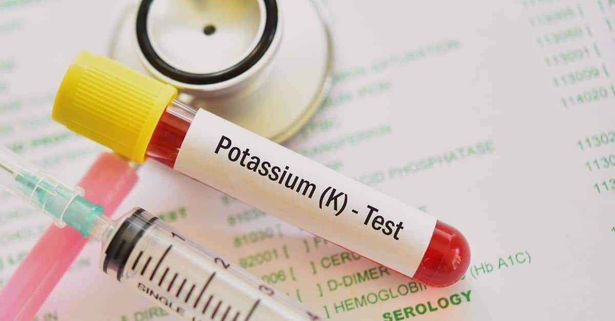 Potassium Lab Values