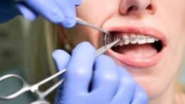 What Is an Orthodontist