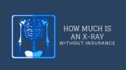 How Much Is an X-Ray Without Insurance