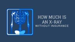 How Much Is an X-Ray Without Insurance