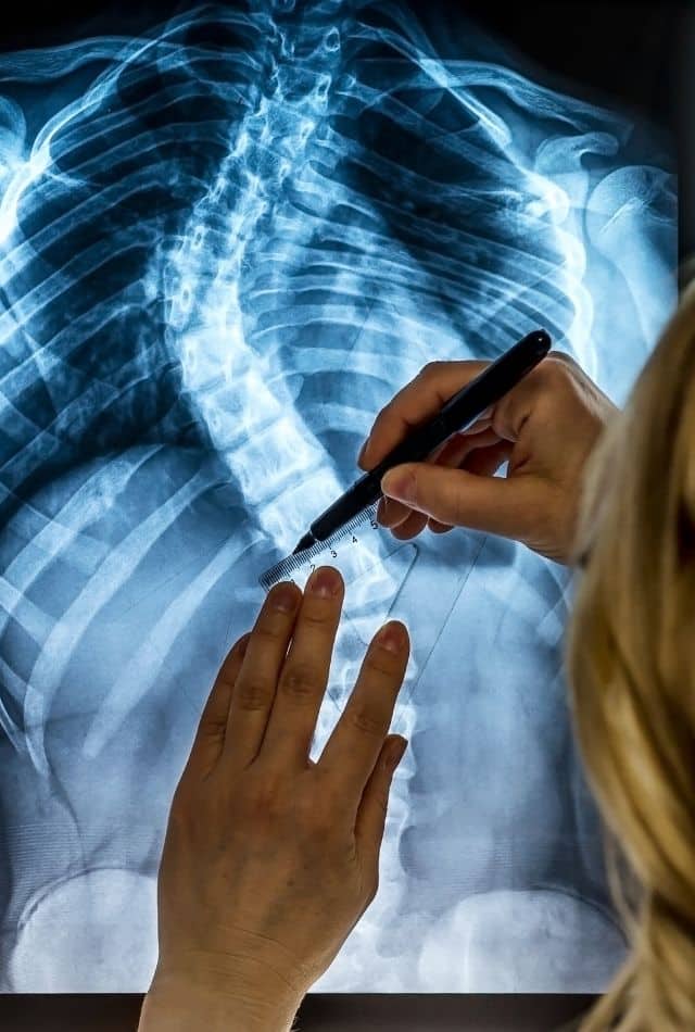 How Much Is an X-Ray Without Insurance